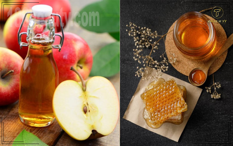 Trị mụn bằng mật ong và dấm táo